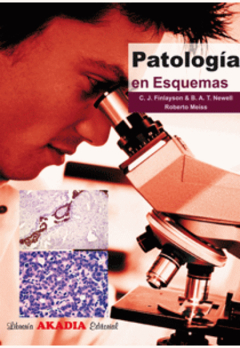 Patologia en esquemas - Finlayson