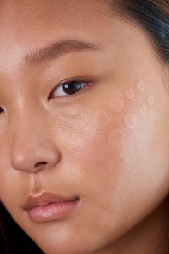 Parches Acne Fast Clear Patch Coony en internet