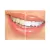 6 Seringas Whiteness Perfect 22% - FGM - Clareador Dental
