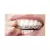 5 Seringas Whiteness Class 7,5% + 1 Par De Moldeira - FGM - loja online