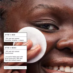 Glossier Solution Skin-Perfecting Daily Chemical 4.4oz/130ml - tienda en línea
