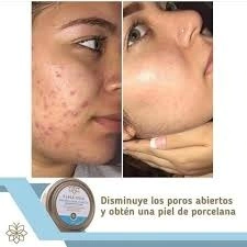 MASCARILLA DE ARCILLA CLASS GOLD PARA EL ROSTRO 150GRS